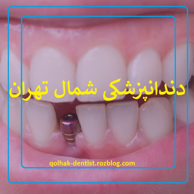 بهترین کلینیک دندانپزشکی شمال تهران پاسداران نیاوران زعفرانیه